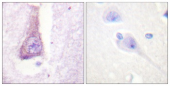 WASP rabbit pAb Antibody