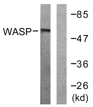 WASP rabbit pAb Antibody