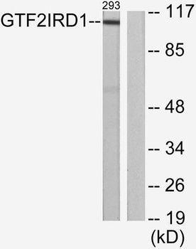 WBSCR11 antibody