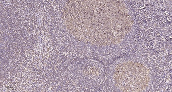 WDHD1 antibody