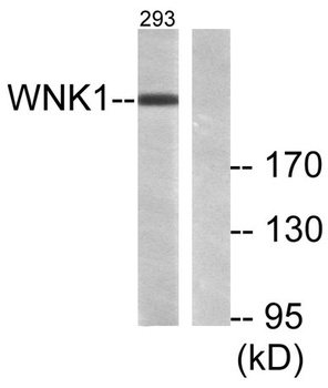 WNK1 rabbit pAb