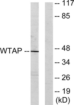 WTAP rabbit pAb
