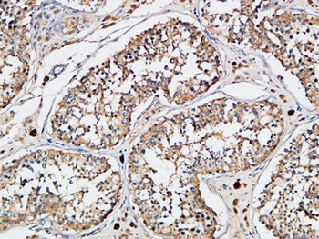 XIAP antibody