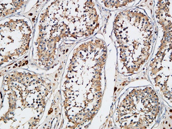 XIAP antibody