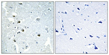 XPG antibody