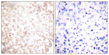 XRCC1 antibody