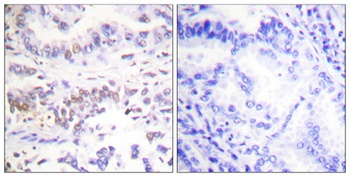 XRCC3 antibody