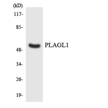 ZAC1 antibody