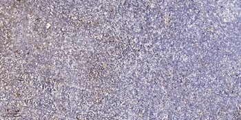 ZADH2 antibody