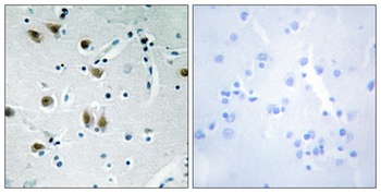 ZBP-89 antibody