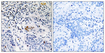 ZBTB40 antibody