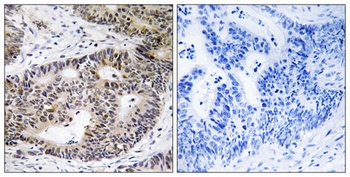 ZFYVE19 antibody