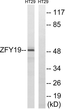 ZFYVE19 rabbit pAb