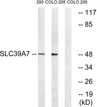 ZIP7 antibody