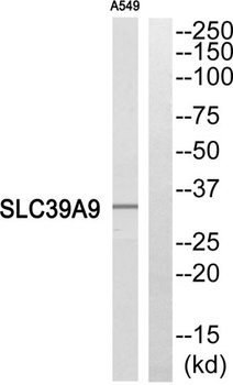 ZIP9 antibody