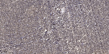 ZNF134 rabbit pAb