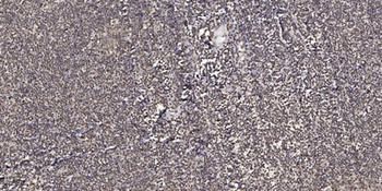 ZNF134 antibody