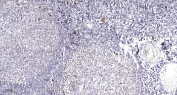 ZNF329 rabbit pAb