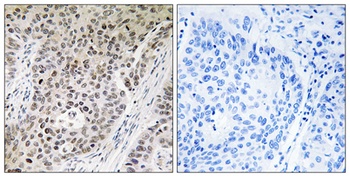 ZNF608 antibody