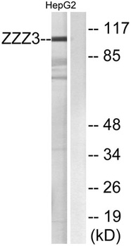 ZZZ3 antibody