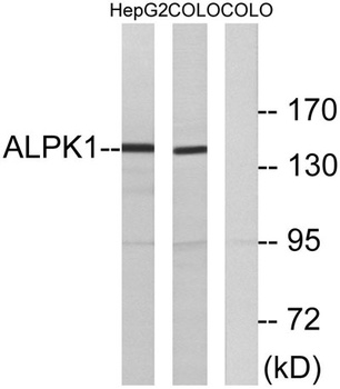 alpha-protein Kinase 1 antibody