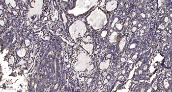 α-protein Kinase 1 rabbit pAb