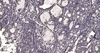 alpha-protein Kinase 1 antibody