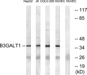 beta-1,3-Gal-T1 antibody