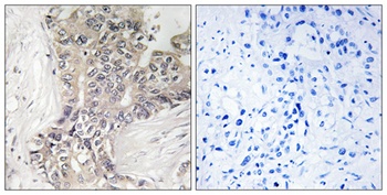 beta-1,3-Gal-TL antibody