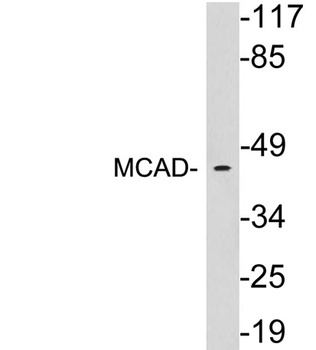MCAD antibody