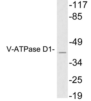 V-ATPase D1 rabbit pAb