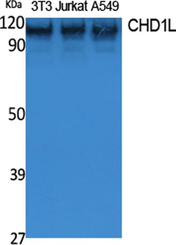 CHD1L rabbit pAb Antibody