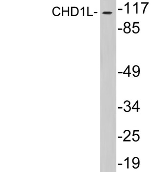 CHD1L rabbit pAb Antibody