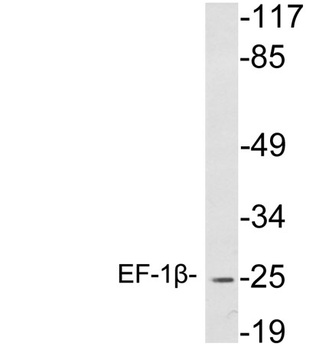 EF-1beta antibody