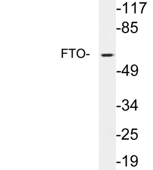 FTO antibody