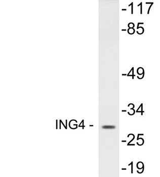 ING4 rabbit pAb