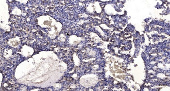 SAP 155 antibody