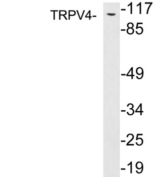 TRPV4 antibody
