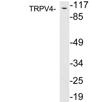 TRPV4 rabbit pAb