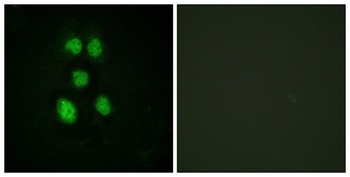 VAV1 rabbit pAb Antibody