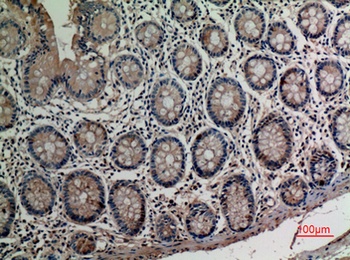 alpha 1 Antitrypsin antibody