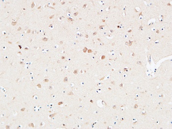 alpha 1 Antitrypsin antibody