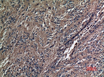 A1BG antibody