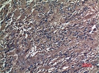 A1BG antibody