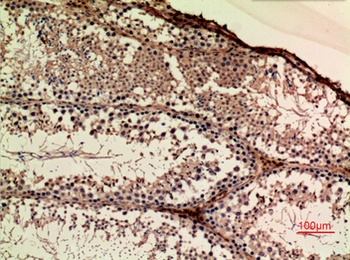 APLP-1 rabbit pAb