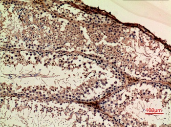 APLP-1 antibody