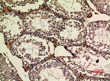APLP-1 rabbit pAb