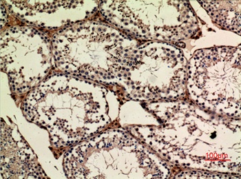 APLP-1 antibody