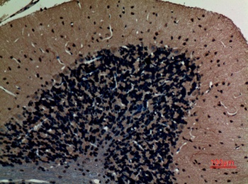 ABCG1 antibody