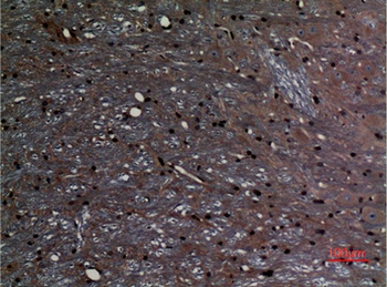 ABCG1 antibody